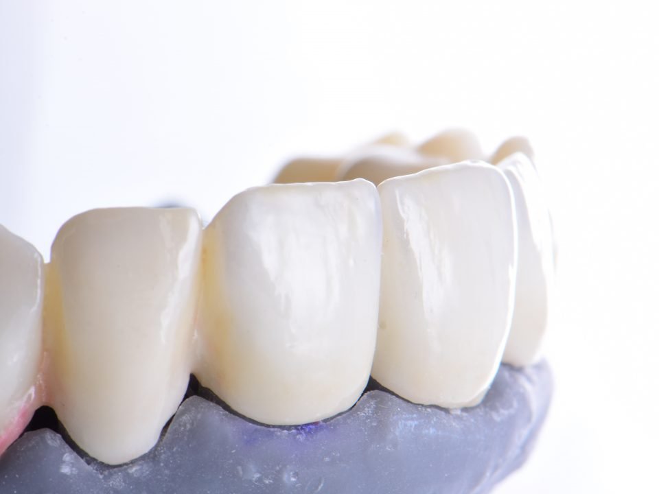 Une rapidité incontournable dans la réalisation de la prothèse dentaire provisoire !