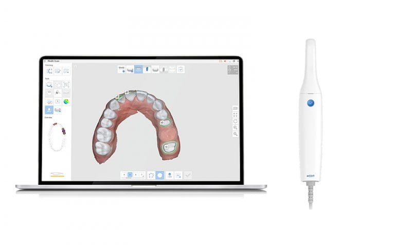 scanner intraoral medit i500 scanner intraoral 3D cabinet dentaire Kara Blida Algerie