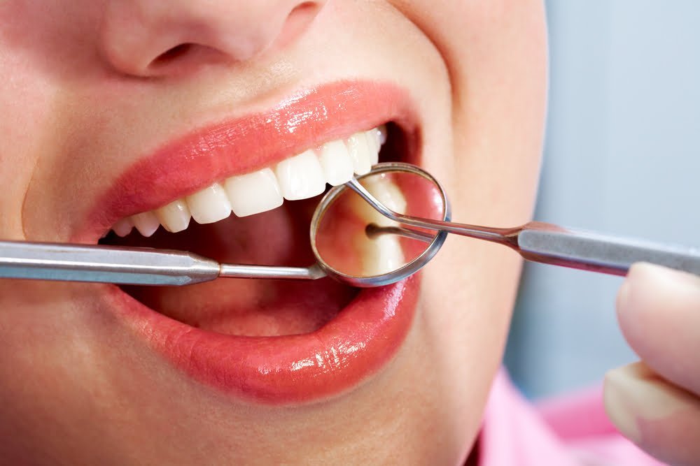 علاجات تسوس الأسنان الأسنان​ عند طبيب الأسنان بالبليدة الجزائر