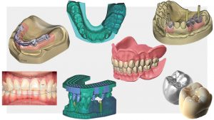 La conception numérique de votre futur sourire au Kara Dental Center