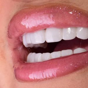 hollywood smile algérie