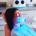 blanchiment dentaire et facette dentaire (hollywood smile) Algérie