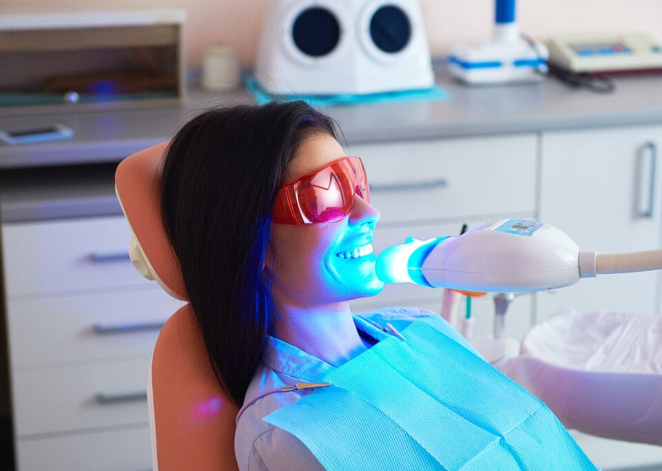 Hollywood Smile et blanchiment dentaire : faut-il les faire ensemble ?