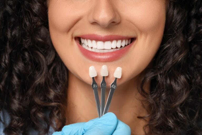dentiste entrain de choisir la bonne facette dentaire en Algérie