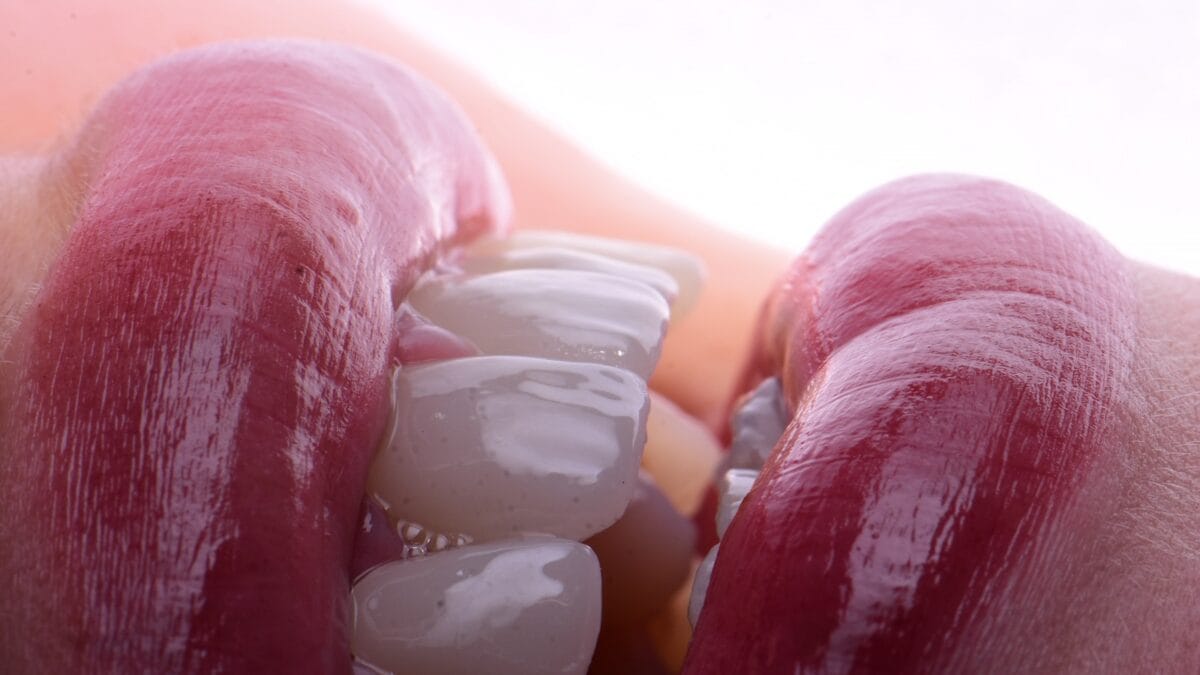 hollywood smile algérie