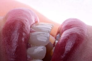 hollywood smile algérie