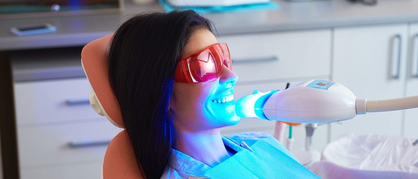 blanchiment dentaire et facette dentaire (hollywood smile) Algérie