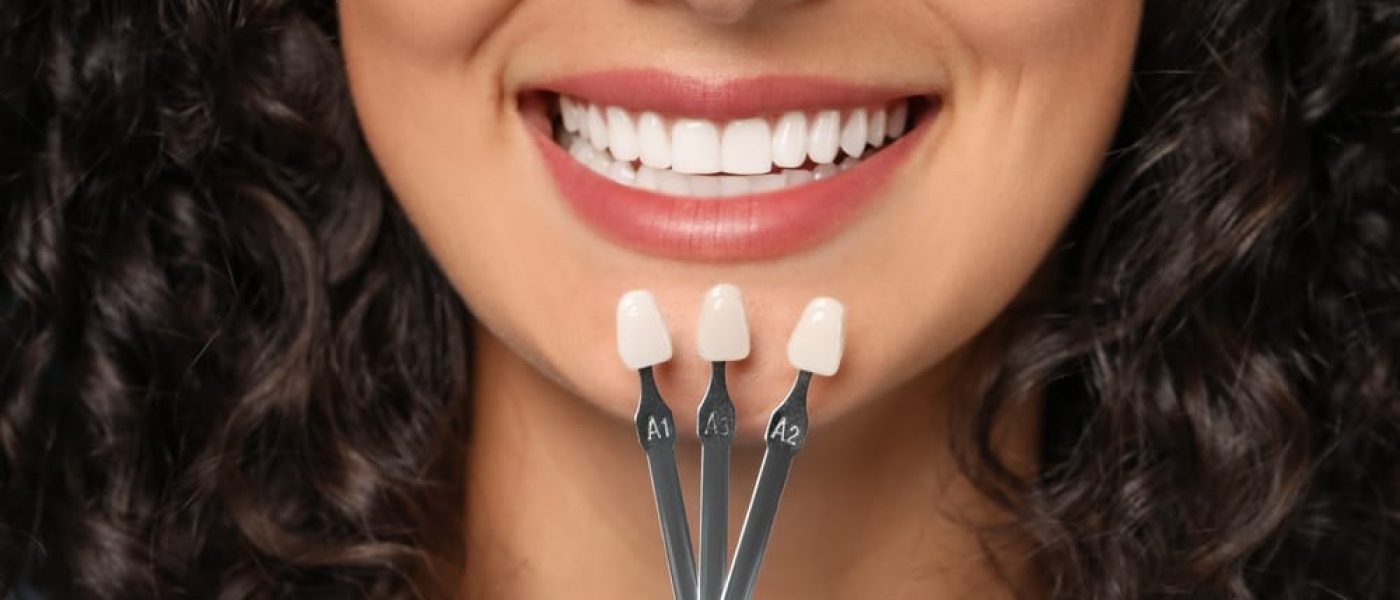 dentiste entrain de choisir la bonne facette dentaire en Algérie