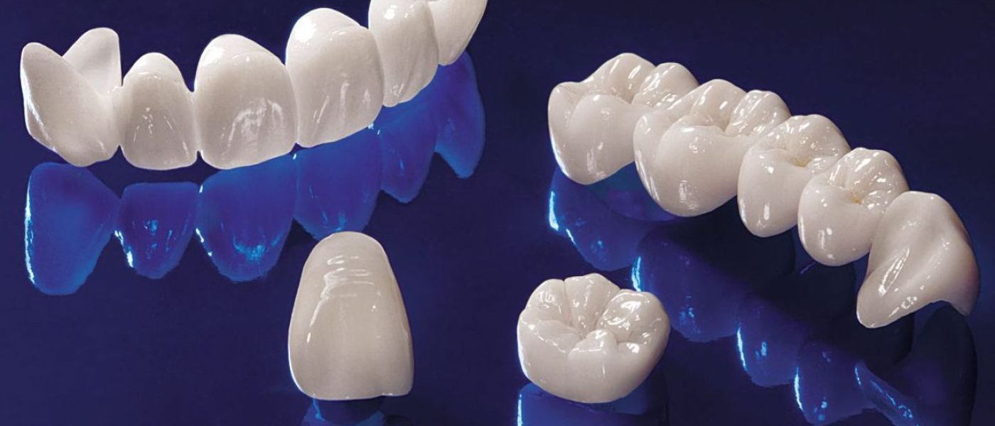 La différence entre la couronne en zircone et la couronne céramo-métallique  - Cabinet dentaire Kara Mostefa