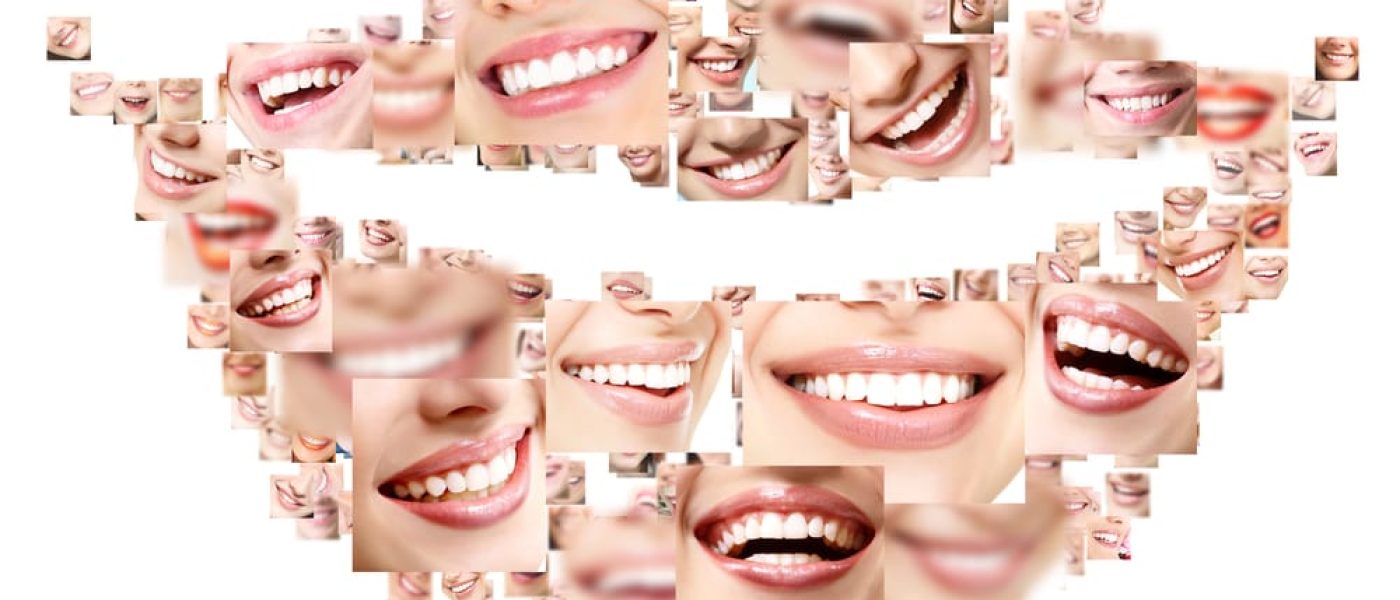 tendence esthétique du sourire en Algérie, France, Turquie et international