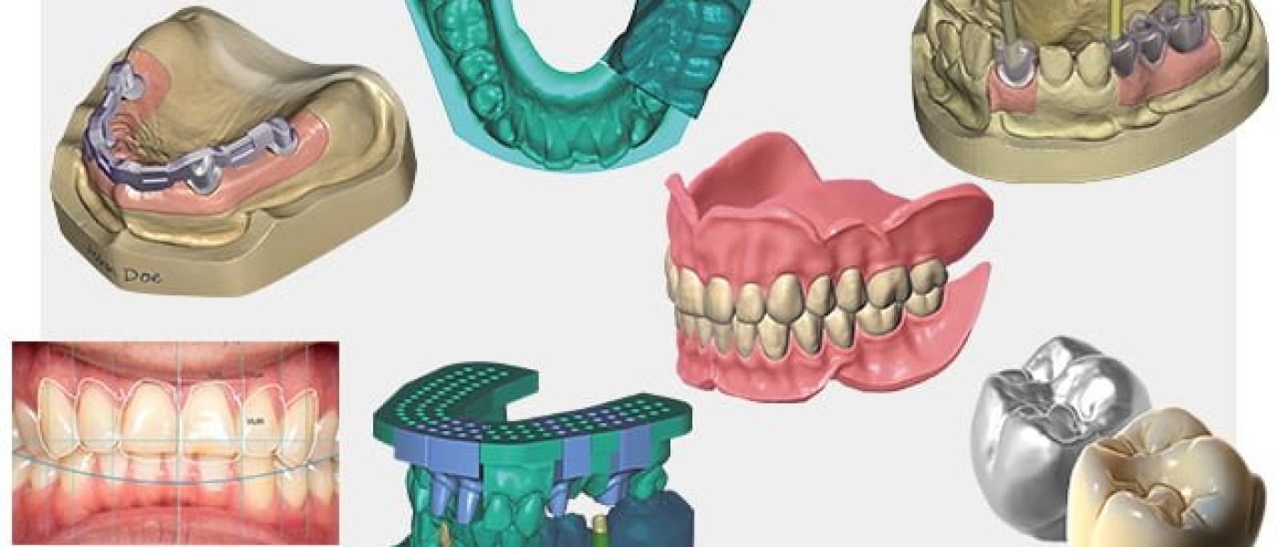 La conception numérique de votre futur sourire au Kara Dental Center