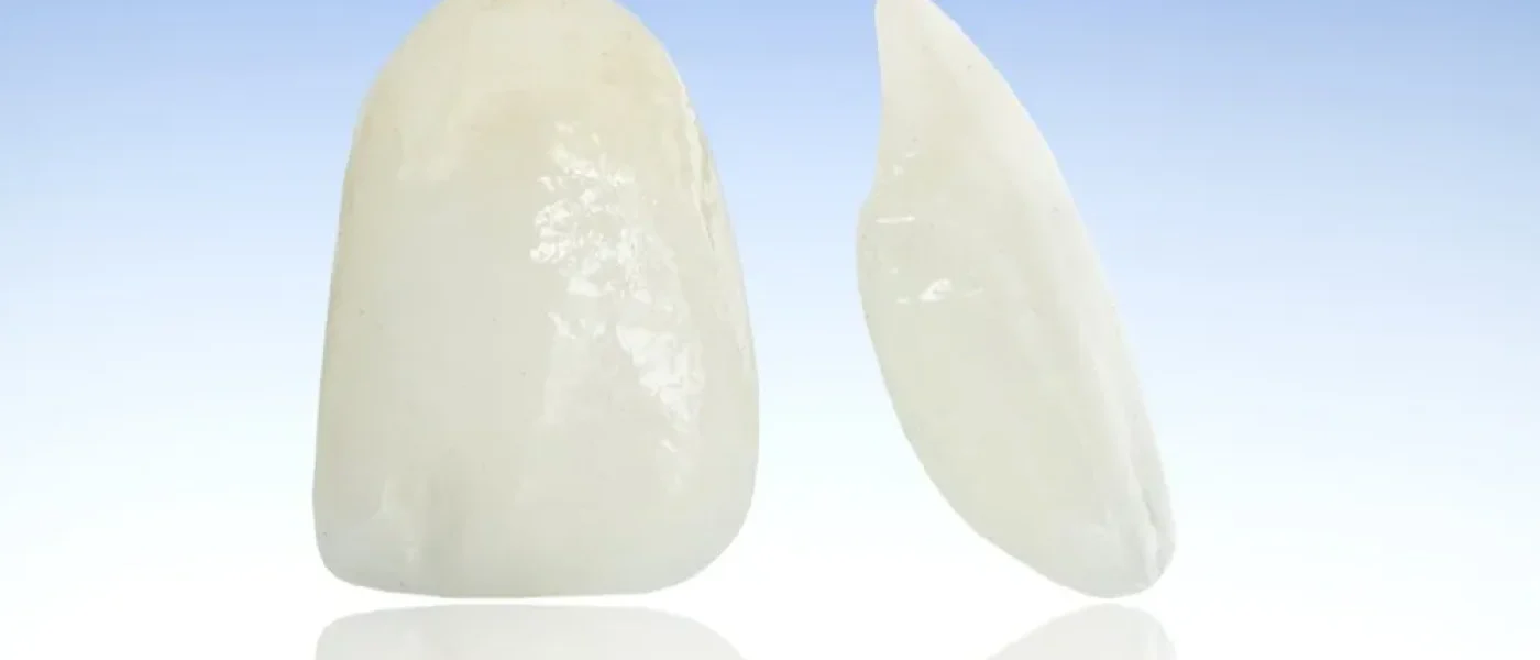 vrai du faux facette dentaire Algérie