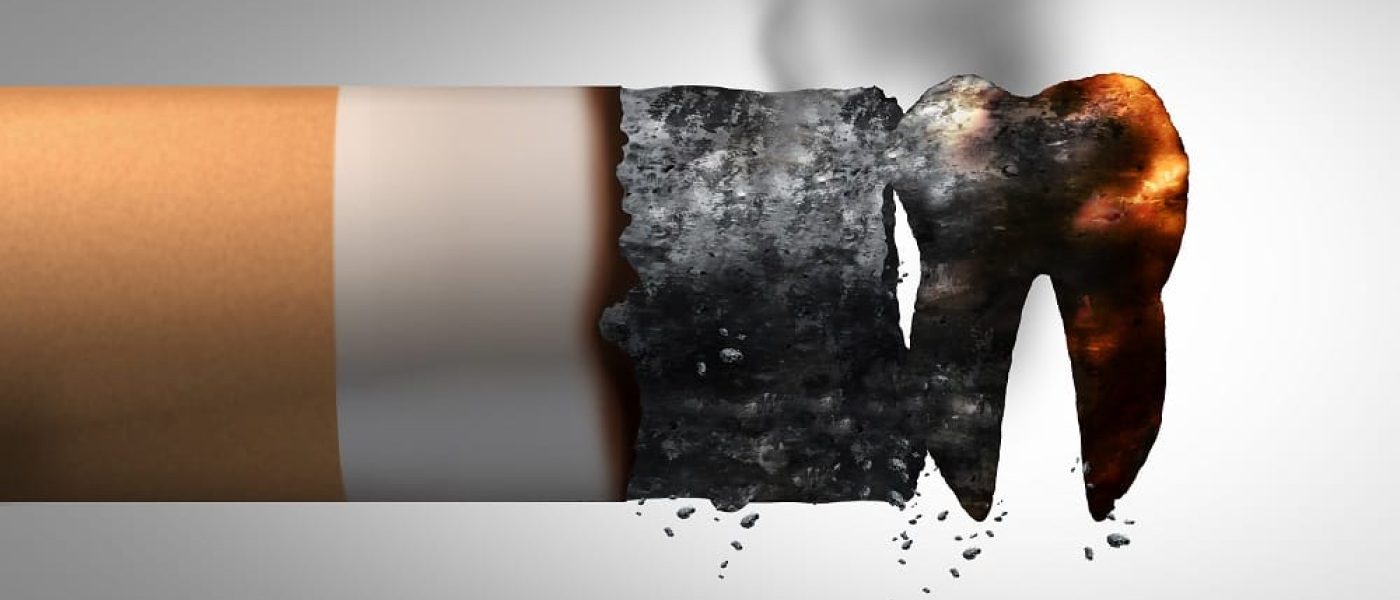 facettes dentaires et problèmes liés aux fumeurs
