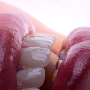 hollywood smile algérie