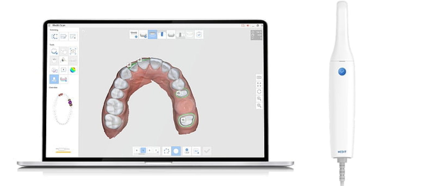 scanner intraoral medit i500 scanner intraoral 3D cabinet dentaire Kara Blida Algerie